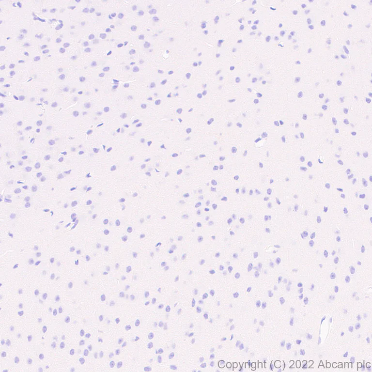 Immunohistochemistry (Formalin/PFA-fixed paraffin-embedded sections) - Anti-Dectin-1 antibody [EPR25360-19] (BSA and Azide free) (AB300498)