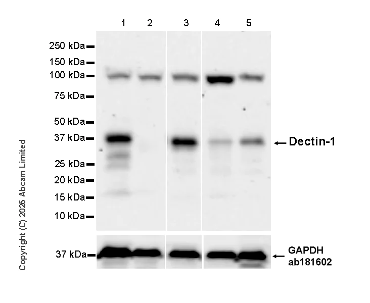 Western blot - Anti-Dectin-1 antibody [EPR29712-507] (AB324238)