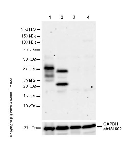 Western blot - Anti-Dectin-1 antibody [EPR29712-507] (AB324238)