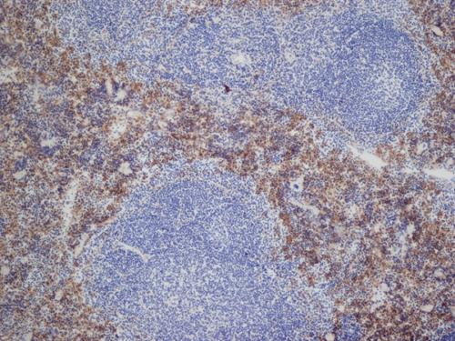 Immunohistochemistry (Frozen sections) - Anti-DECTIN 2 antibody [D2.11E4] (AB157685)