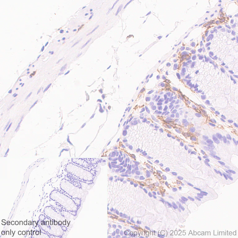 Immunohistochemistry (Formalin/PFA-fixed paraffin-embedded sections) - Anti-DECTIN 2 antibody [EPR30285-525] (AB323860)