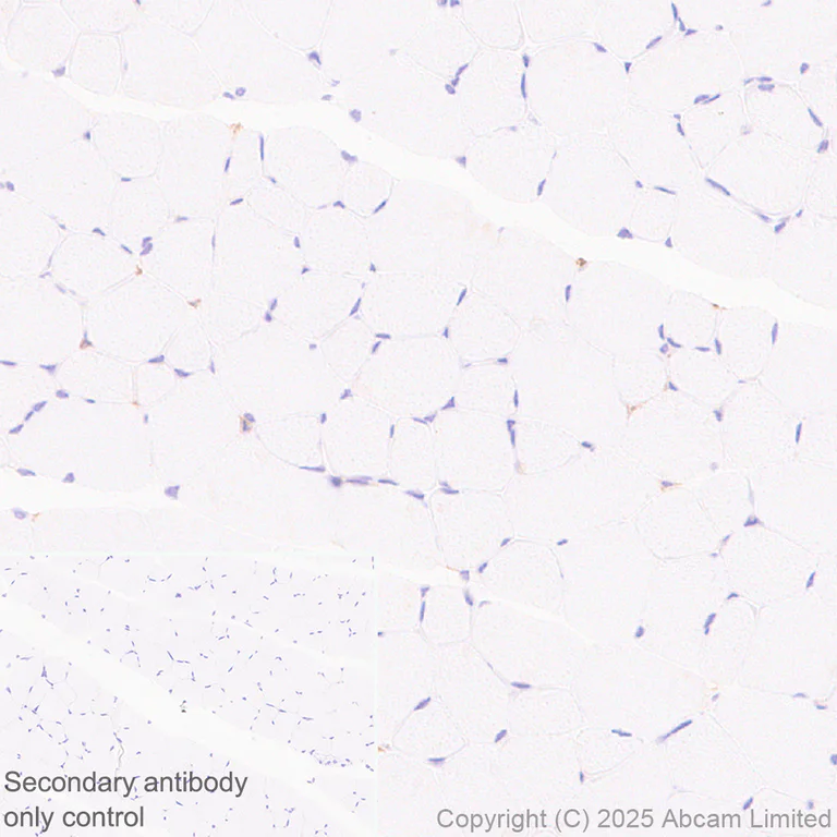 Immunohistochemistry (Formalin/PFA-fixed paraffin-embedded sections) - Anti-DECTIN 2 antibody [EPR30285-525] (AB323860)