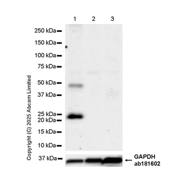 Western blot - Anti-DECTIN 2 antibody [EPR30285-525] (AB323860)