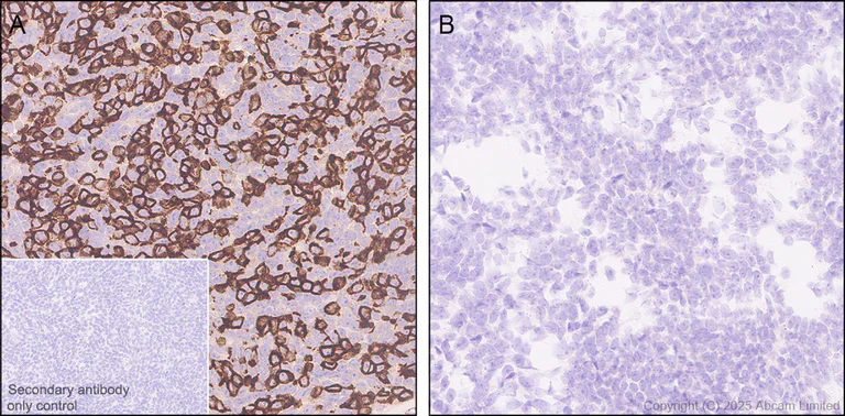 Immunohistochemistry (Formalin/PFA-fixed paraffin-embedded sections) - Anti-DECTIN 2 antibody [EPR30285-525] - BSA and Azide free (AB323875)