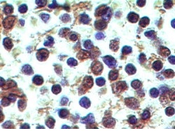Immunohistochemistry (Formalin/PFA-fixed paraffin-embedded sections) - Anti-DECTIN 2 antibody [IMG3D1] (AB107572), expandable thumbnail