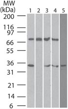 Western blot - Anti-DECTIN 2 antibody [IMG3D1] (AB107572), expandable thumbnail