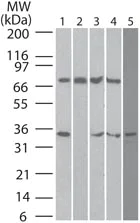 Western blot - Anti-DECTIN 2 antibody [IMG3D1] (AB107572)