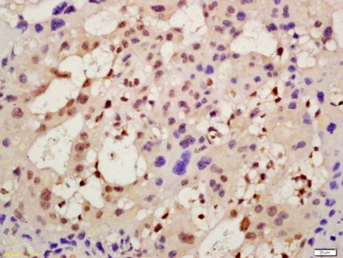 Immunohistochemistry (Formalin/PFA-fixed paraffin-embedded sections) - Anti-DEGA antibody (AB216591), expandable thumbnail