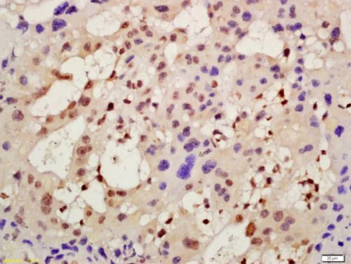 Immunohistochemistry (Formalin/PFA-fixed paraffin-embedded sections) - Anti-DEGA antibody (AB216591)