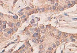 Immunohistochemistry (Formalin/PFA-fixed paraffin-embedded sections) - Anti-DEGA antibody (AB84416)