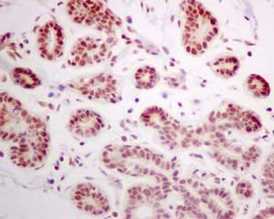 Immunohistochemistry (Formalin/PFA-fixed paraffin-embedded sections) - Anti-DEK antibody [EPR11034] (AB166624), expandable thumbnail