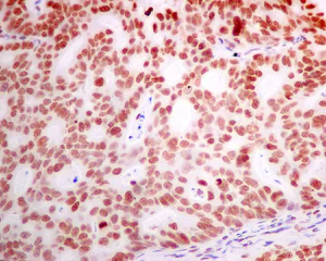 Immunohistochemistry (Formalin/PFA-fixed paraffin-embedded sections) - Anti-DEK antibody [EPR11034] (AB166624)
