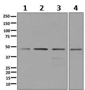 Western blot - Anti-DEK antibody [EPR11034] (AB166624), expandable thumbnail