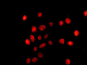 Immunocytochemistry/ Immunofluorescence - Anti-DEK antibody [EPR11034] - BSA and Azide free (AB249362)