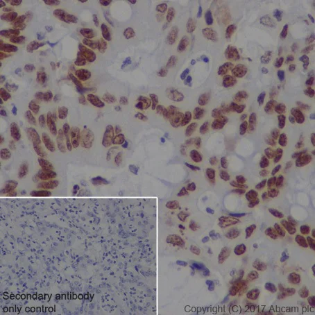 Immunohistochemistry (Formalin/PFA-fixed paraffin-embedded sections) - Anti-DEK antibody [EPR20401] (AB221545)