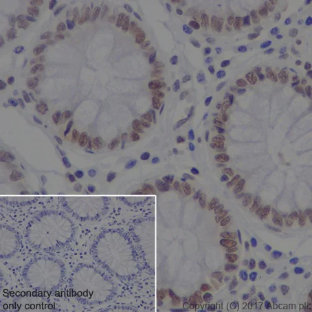Immunohistochemistry (Formalin/PFA-fixed paraffin-embedded sections) - Anti-DEK antibody [EPR20401] (AB221545)