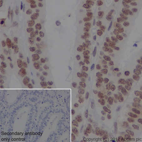 Immunohistochemistry (Formalin/PFA-fixed paraffin-embedded sections) - Anti-DEK antibody [EPR20401] (AB221545)