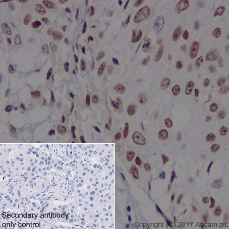 Immunohistochemistry (Formalin/PFA-fixed paraffin-embedded sections) - Anti-DEK antibody [EPR20401] (AB221545)