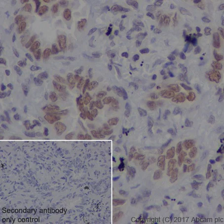 Immunohistochemistry (Formalin/PFA-fixed paraffin-embedded sections) - Anti-DEK antibody [EPR20401] - BSA and Azide free (AB251566)