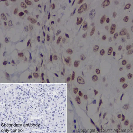 Immunohistochemistry (Formalin/PFA-fixed paraffin-embedded sections) - Anti-DEK antibody [EPR20401] - BSA and Azide free (AB251566)