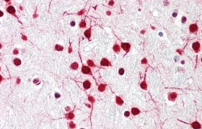 Immunohistochemistry (Formalin/PFA-fixed paraffin-embedded sections) - Anti-DELE antibody - N-terminal (AB189958), expandable thumbnail