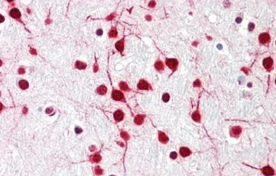 Immunohistochemistry (Formalin/PFA-fixed paraffin-embedded sections) - Anti-DELE antibody - N-terminal (AB189958)