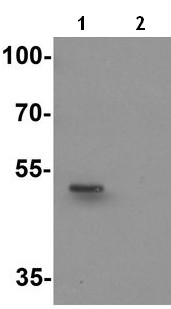Western blot - Anti-DELE antibody - N-terminal (AB189958), expandable thumbnail