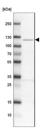 Western blot - Anti-Delphilin antibody (AB126355)