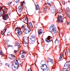 Immunohistochemistry (Formalin/PFA-fixed paraffin-embedded sections) - Anti-delta 1 Catenin/CAS antibody (AB64479)