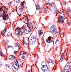 Immunohistochemistry (Formalin/PFA-fixed paraffin-embedded sections) - Anti-delta 1 Catenin/CAS antibody (AB64479)