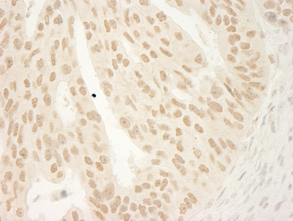 Immunohistochemistry (Formalin/PFA-fixed paraffin-embedded sections) - Anti-delta 1 Catenin/CAS antibody (AB72039)