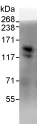 Immunoprecipitation - Anti-delta 1 Catenin/CAS antibody (AB72039)