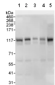 Western blot - Anti-delta 1 Catenin/CAS antibody (AB72039)