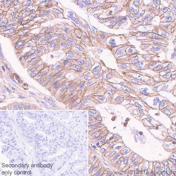 Immunohistochemistry (Formalin/PFA-fixed paraffin-embedded sections) - Anti-delta 1 Catenin/CAS antibody [EPR357(2)] - BSA and Azide free (AB239916)
