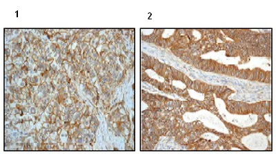 Immunohistochemistry (Formalin/PFA-fixed paraffin-embedded sections) - Anti-delta 1 Catenin/CAS antibody [EPR357(2)] - BSA and Azide free (AB239916)