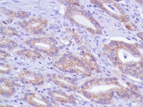 Immunohistochemistry (Formalin/PFA-fixed paraffin-embedded sections) - Anti-delta 1 Catenin/CAS antibody [SP63] - BSA and Azide free (AB236441)