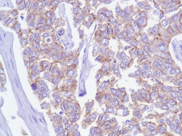 Immunohistochemistry (Formalin/PFA-fixed paraffin-embedded sections) - Anti-delta 1 Catenin/CAS antibody [SP63] - BSA and Azide free (AB236441)