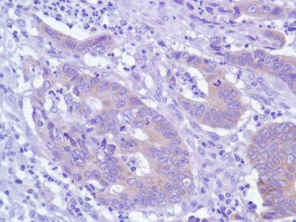 Immunohistochemistry (Formalin/PFA-fixed paraffin-embedded sections) - Anti-delta 1 Catenin/CAS antibody [SP63] - BSA and Azide free (AB236441)