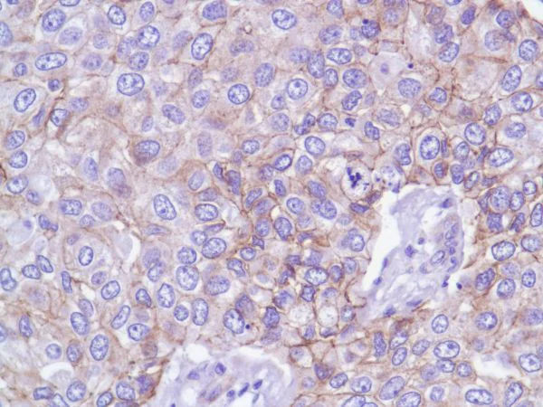 Immunohistochemistry (Formalin/PFA-fixed paraffin-embedded sections) - Anti-delta 1 Catenin/CAS antibody [SP63] - BSA and Azide free (AB236441)