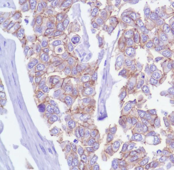 Immunohistochemistry (Formalin/PFA-fixed paraffin-embedded sections) - Anti-delta 1 Catenin/CAS antibody [SP63] - BSA and Azide free (AB236441)