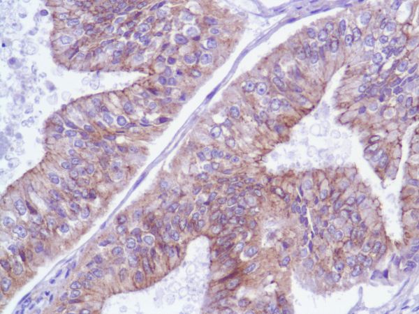 Immunohistochemistry (Formalin/PFA-fixed paraffin-embedded sections) - Anti-delta 1 Catenin/CAS antibody [SP63] - BSA and Azide free (AB236441)