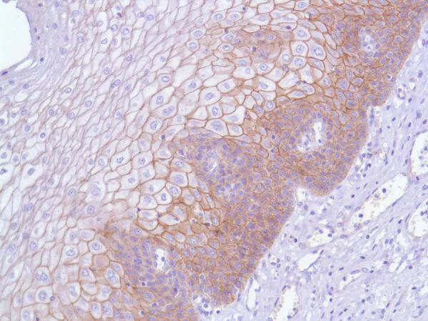 Immunohistochemistry (Formalin/PFA-fixed paraffin-embedded sections) - Anti-delta 1 Catenin/CAS antibody [SP63] - BSA and Azide free (AB236441)