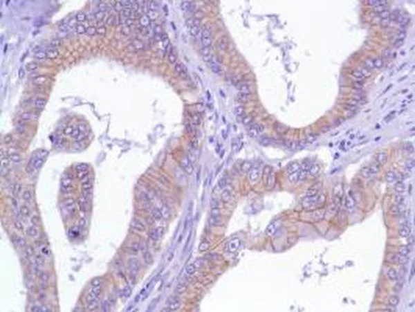 Immunohistochemistry (Formalin/PFA-fixed paraffin-embedded sections) - Anti-delta 1 Catenin/CAS antibody [SP63] - BSA and Azide free (AB236441)