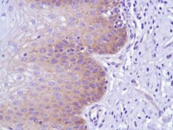 Immunohistochemistry (Formalin/PFA-fixed paraffin-embedded sections) - Anti-delta 1 Catenin/CAS antibody [SP63] - BSA and Azide free (AB236441)