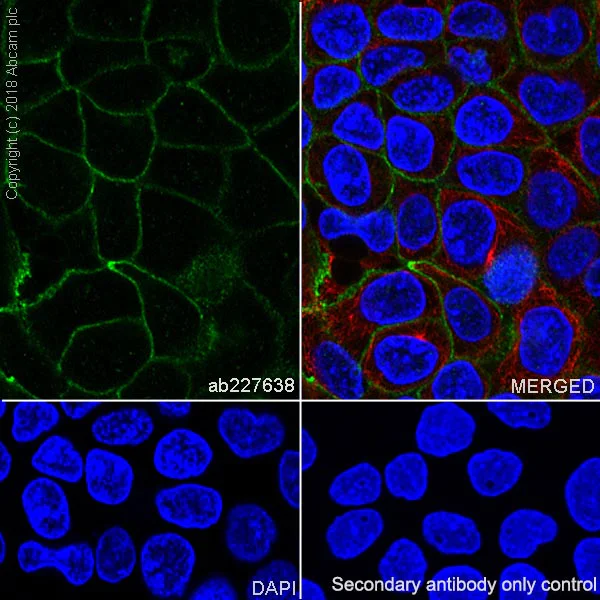 Immunocytochemistry/ Immunofluorescence - Anti-delta 1 Catenin/CAS antibody [SP63] - C-terminal (AB227638)