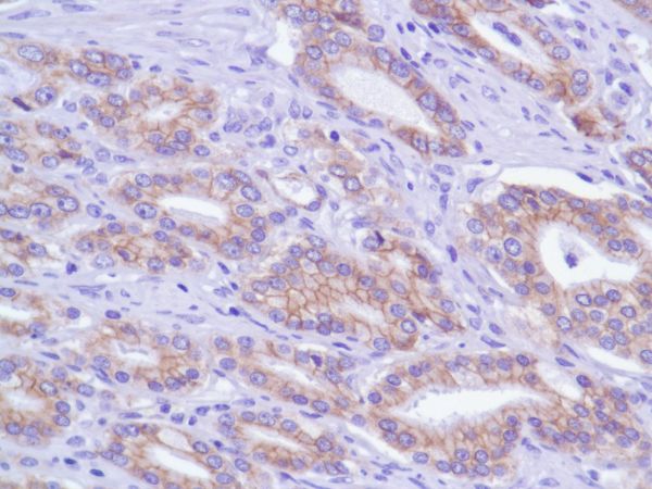Immunohistochemistry (Formalin/PFA-fixed paraffin-embedded sections) - Anti-delta 1 Catenin/CAS antibody [SP63] - C-terminal (ab227638), expandable thumbnail