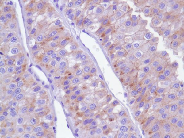 Immunohistochemistry (Formalin/PFA-fixed paraffin-embedded sections) - Anti-delta 1 Catenin/CAS antibody [SP63] - C-terminal (ab227638), expandable thumbnail
