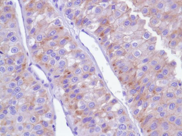 Immunohistochemistry (Formalin/PFA-fixed paraffin-embedded sections) - Anti-delta 1 Catenin/CAS antibody [SP63] - C-terminal (AB227638)