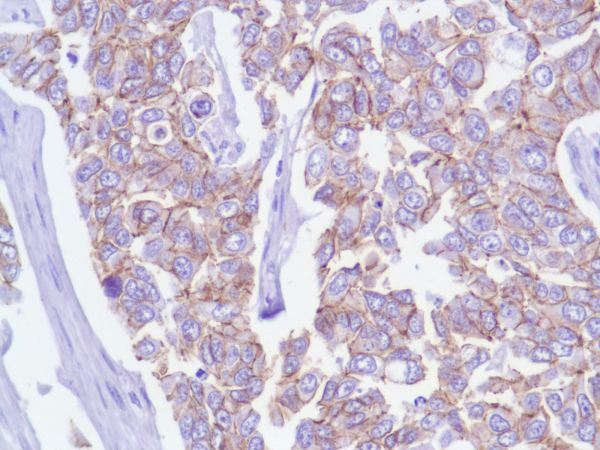 Immunohistochemistry (Formalin/PFA-fixed paraffin-embedded sections) - Anti-delta 1 Catenin/CAS antibody [SP63] - C-terminal (AB227638), expandable thumbnail