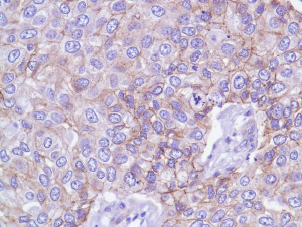 Immunohistochemistry (Formalin/PFA-fixed paraffin-embedded sections) - Anti-delta 1 Catenin/CAS antibody [SP63] - C-terminal (AB227638), expandable thumbnail